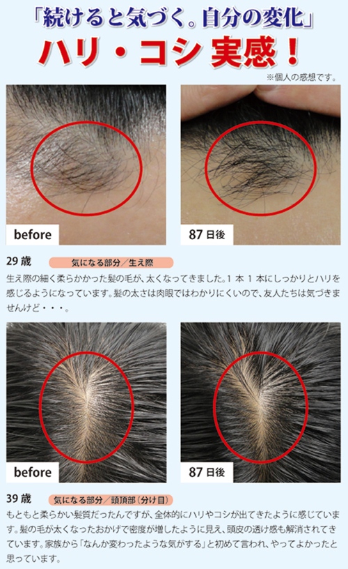 スカルプケアセット